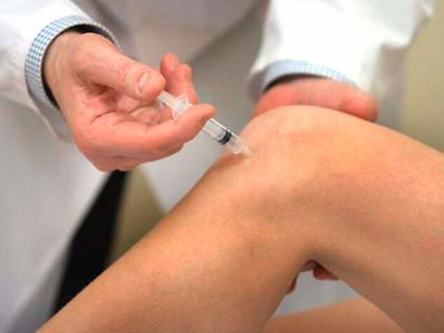 Intra-articular injection is one of the most progressive forms of knee arthrosis treatment