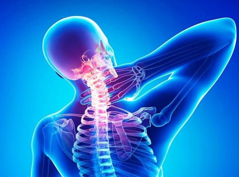 The cervical spine osteochondrosis