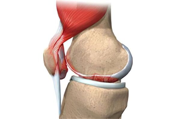 The joint complications