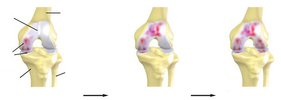 The joint sections