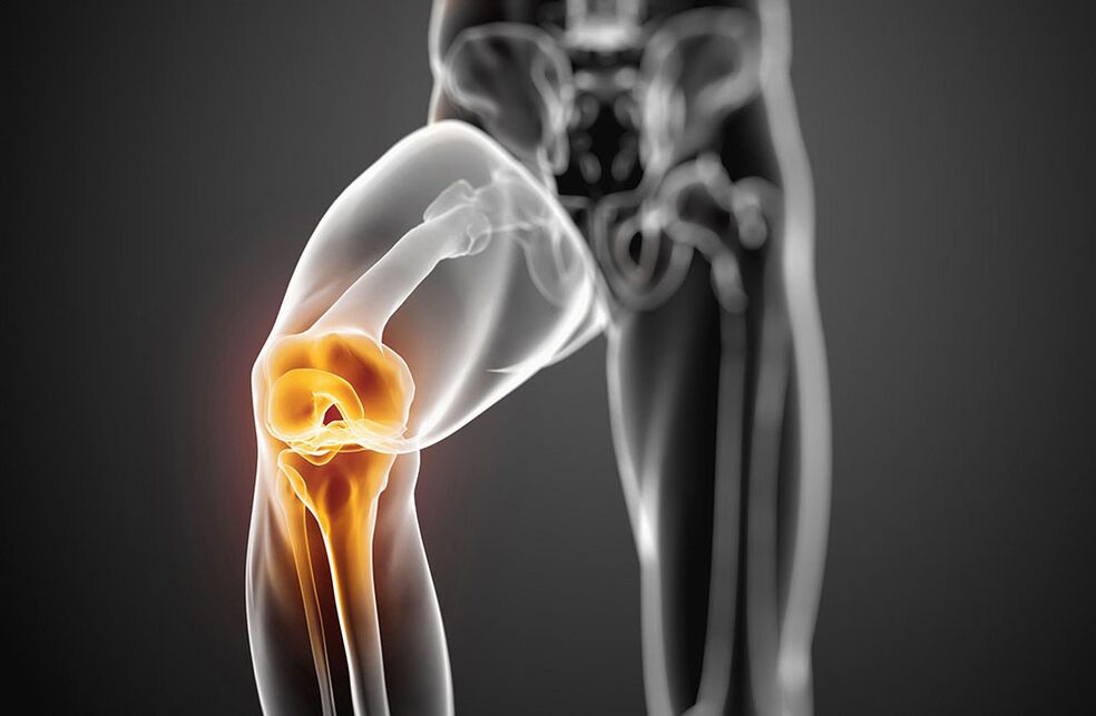 The knee joint is joint joint