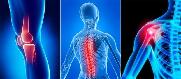 Joint pain in joint pain